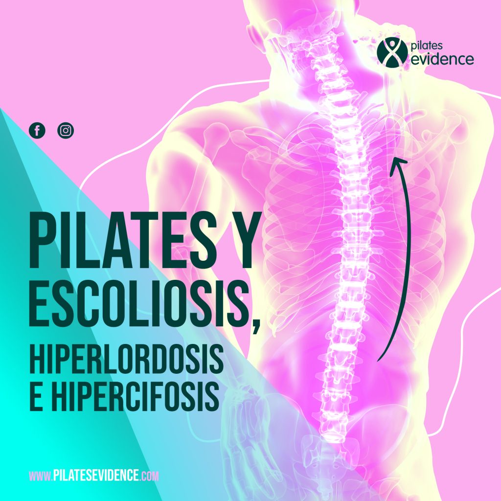 Pilates-y-Escoliosis-hiperlordosis-e-hipercifosis